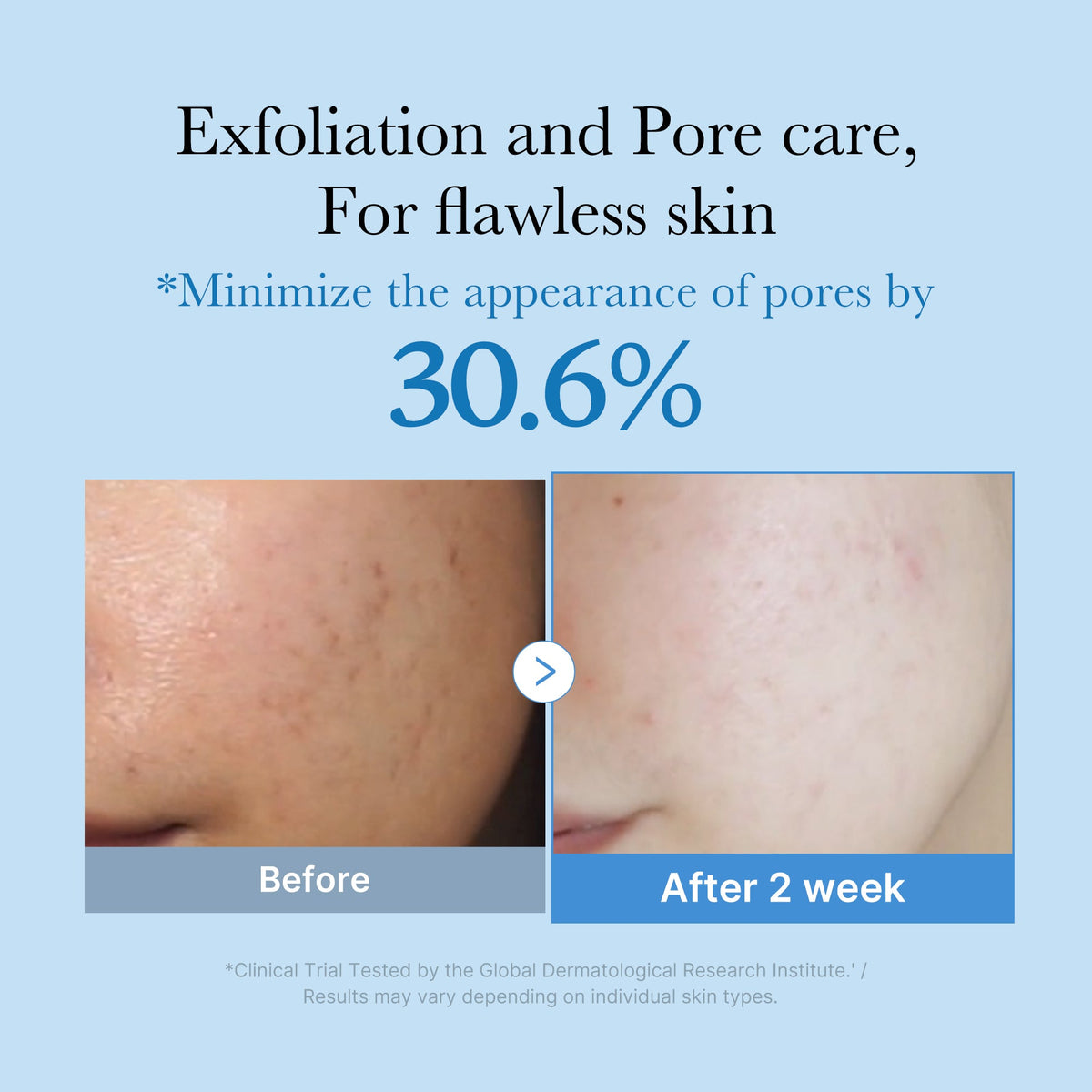 zero-pore-toner-e9 01_d6480b4e-3c08-4954-994a-ed5212c1839c.jpg