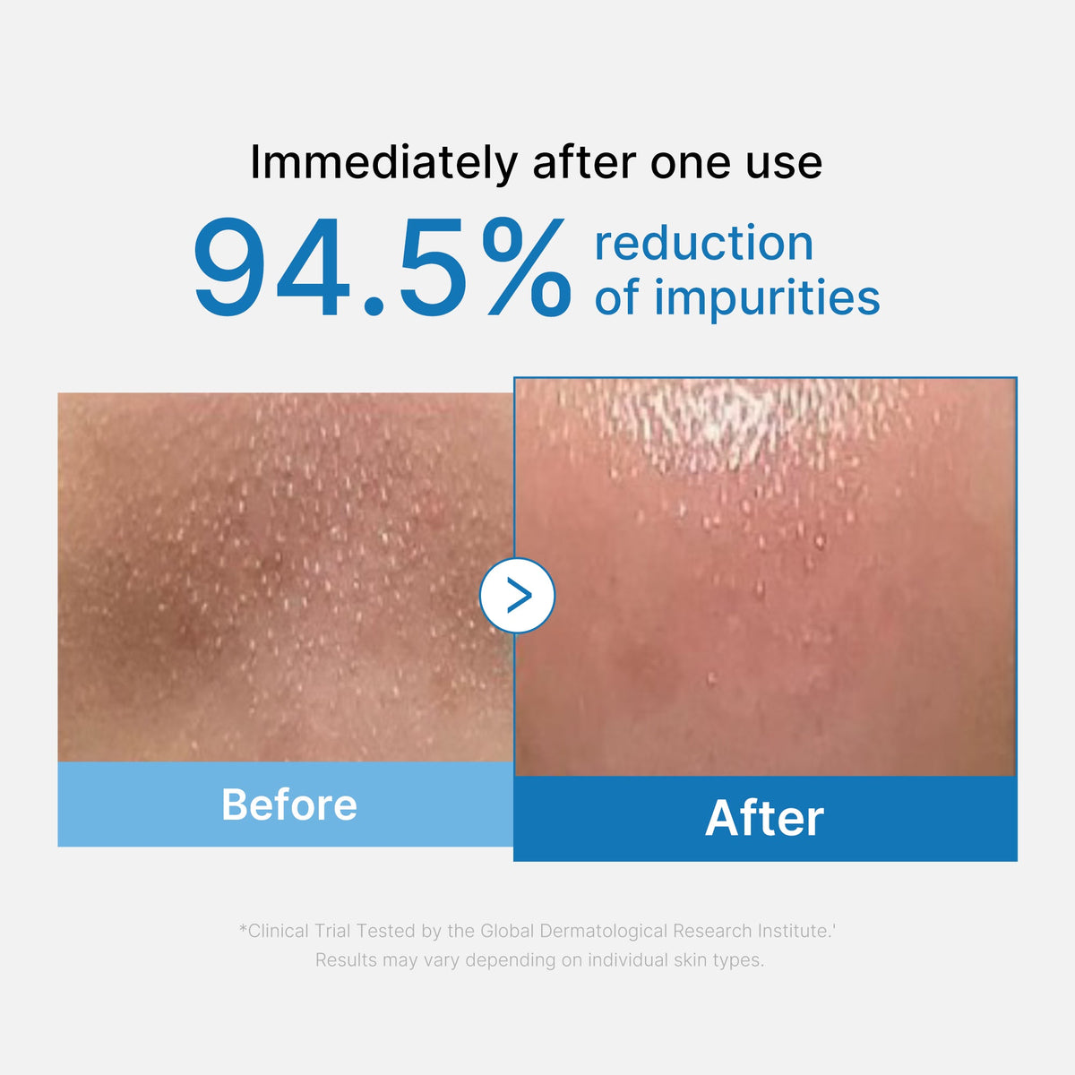 zero-pore-blackhead-deep-cleansing-oil-z1 01_eed557ec-5857-46a2-8b17-dbd67c692dcb.jpg