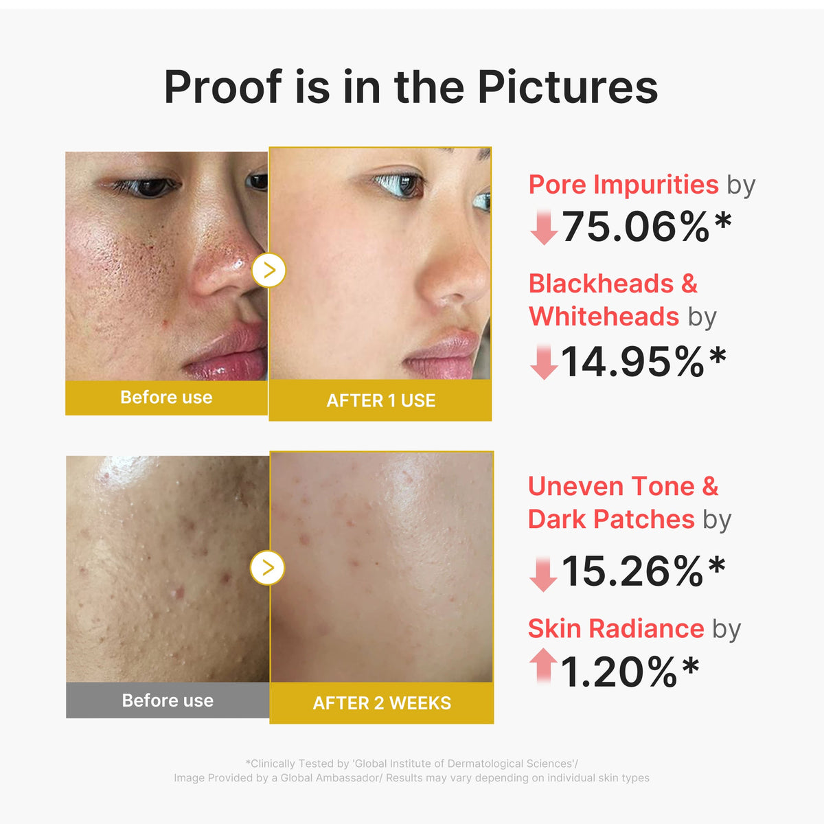 kojic-acid-turmeric-peel-shot-x5 02_45fe66d3-b3f6-4100-aa52-2afd7eded417.jpg