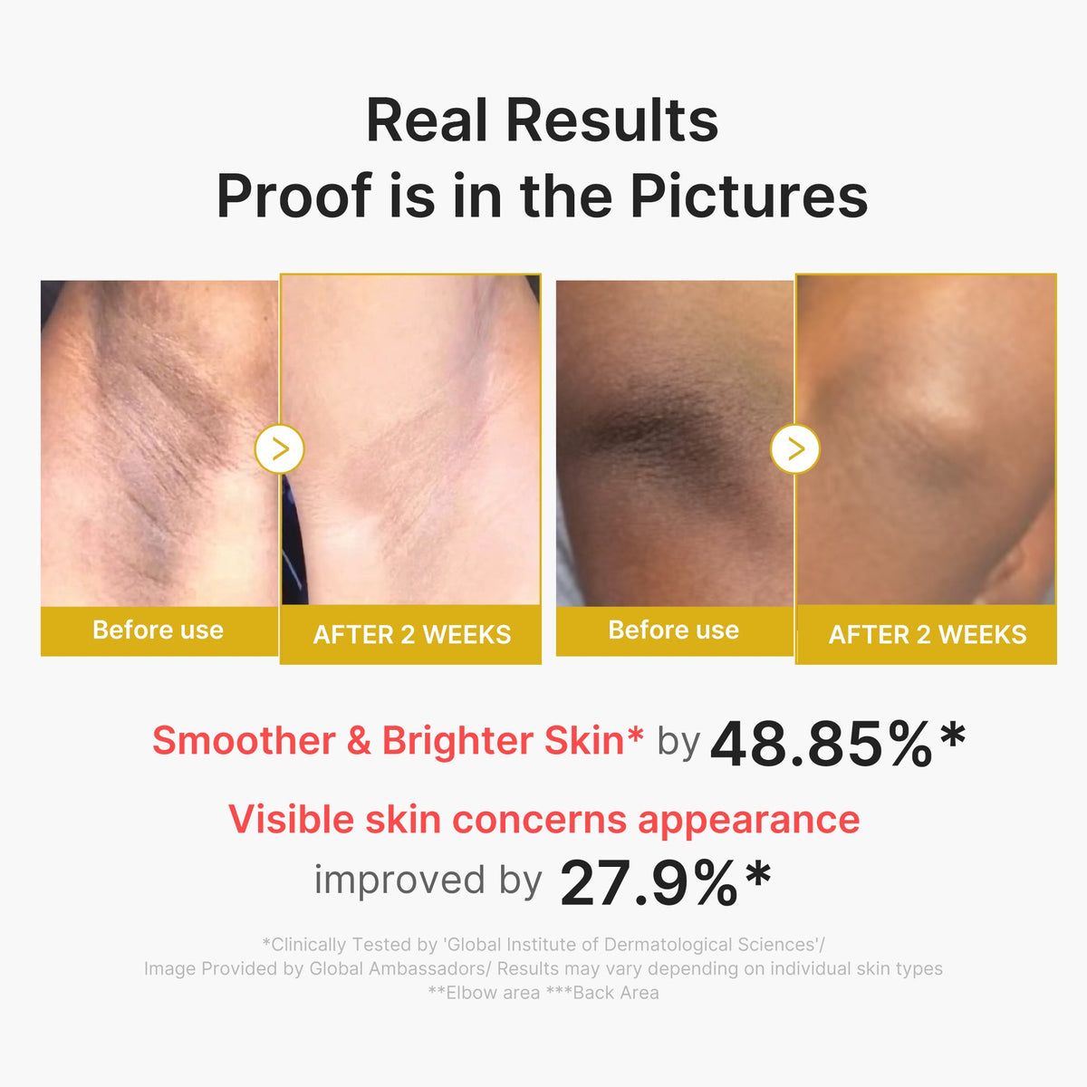 kojic-acid-turmeric-body-peel-shot-o1 02_72880cfc-382b-440b-8152-7e3dce87da2a.jpg