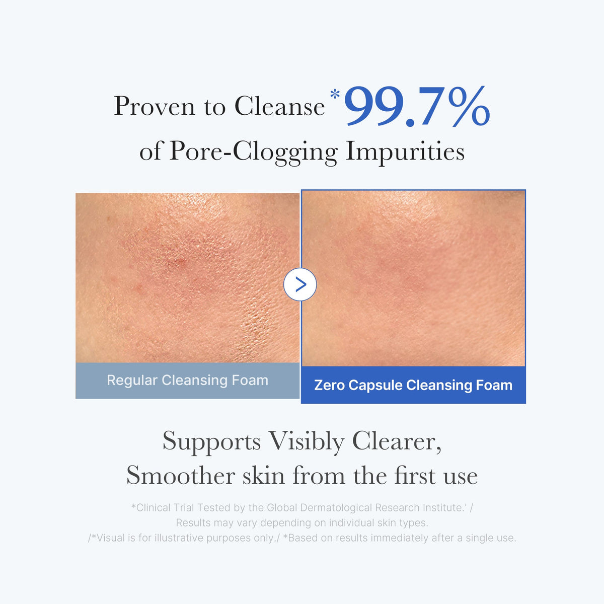 zero-pore-capsule-cleansing-foam-d0 02_c1fb9dfb-86c5-4038-8ff8-490d1006276c.jpg