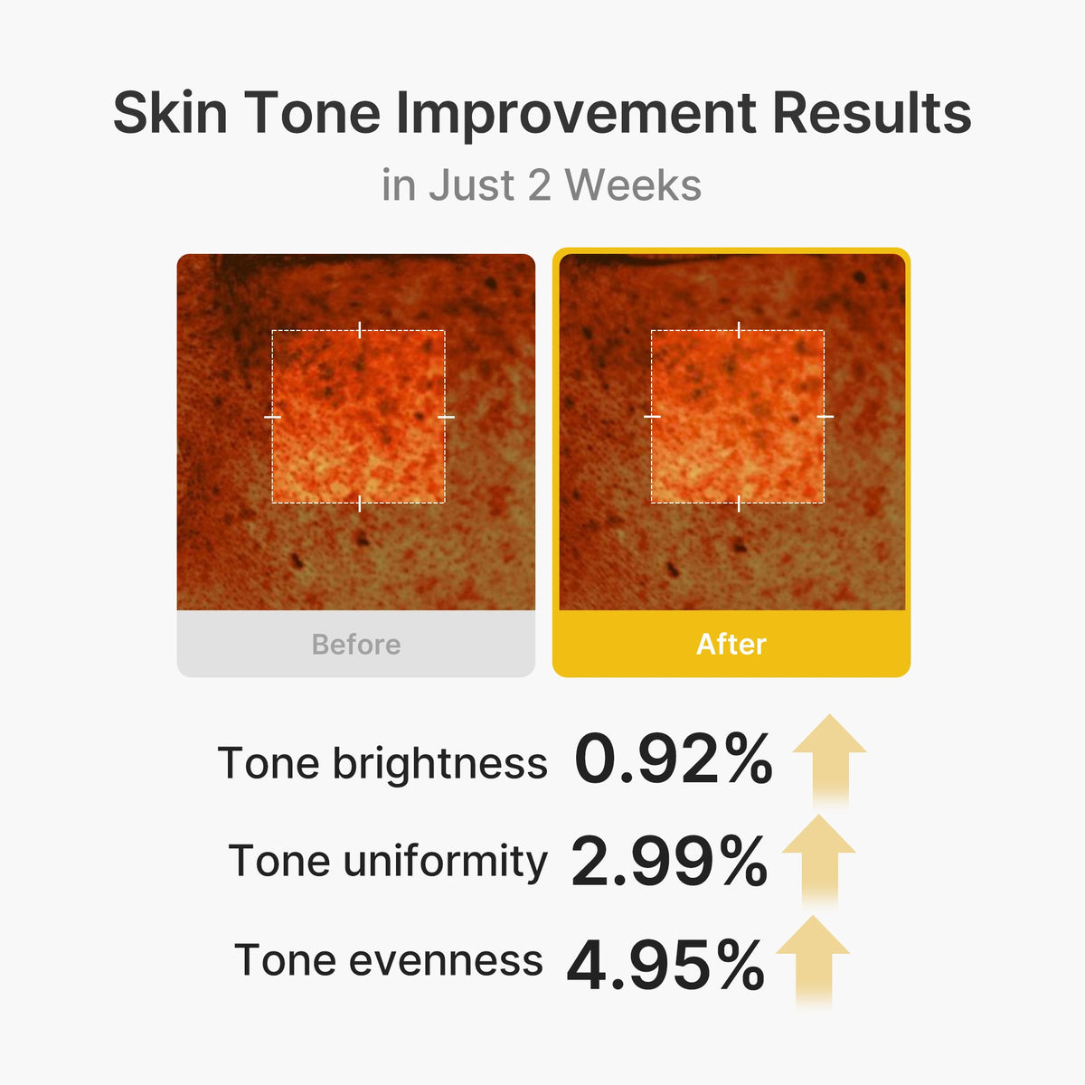 kojic-acid-turmeric-vita-capsule-cream-c8 03_2b626701-fc6c-4702-9e96-a2157a4f7f9d.jpg
