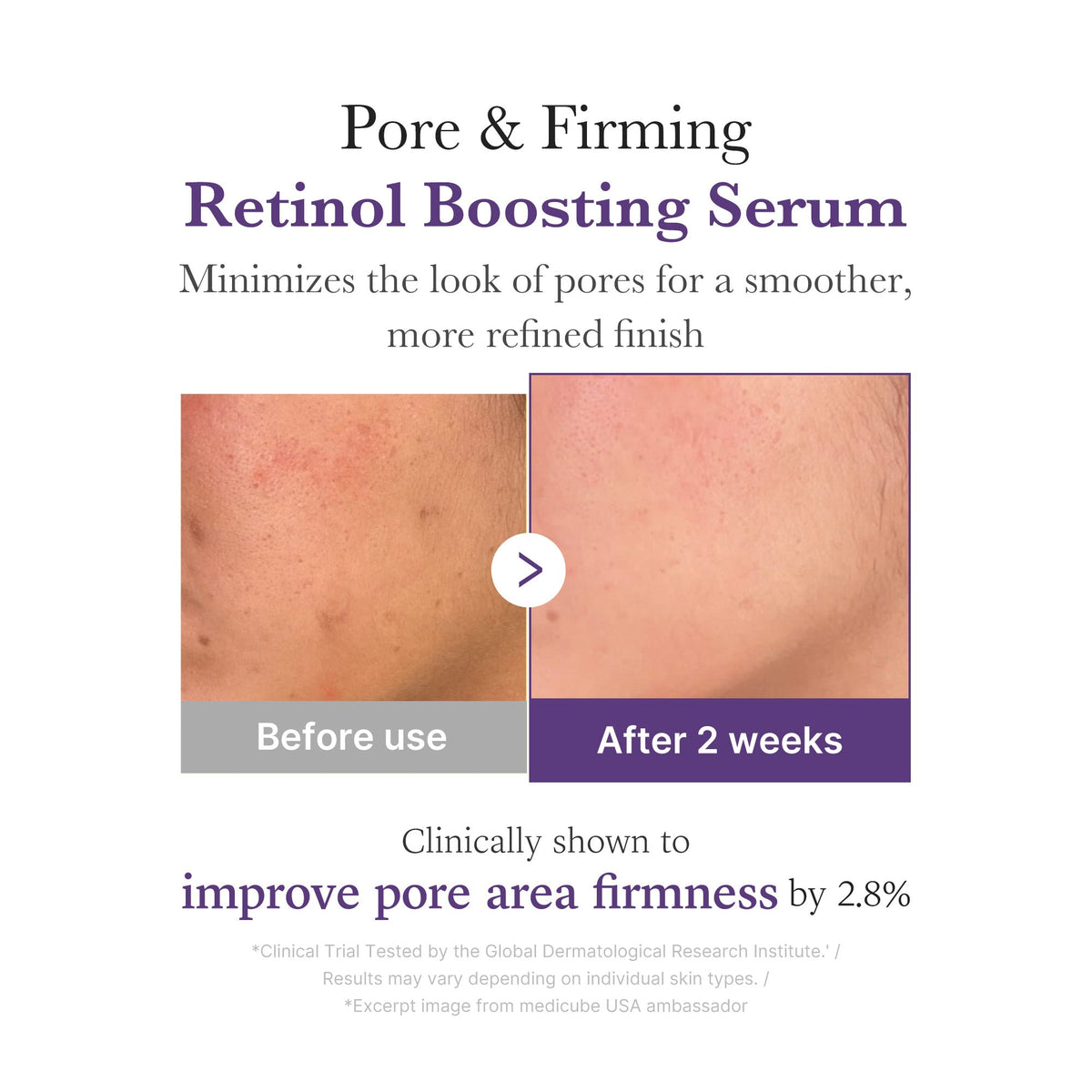 retinol-nmn-boosting-serum-f2 03_3510e7a5-5633-4a18-81ea-1389593bd517.jpg