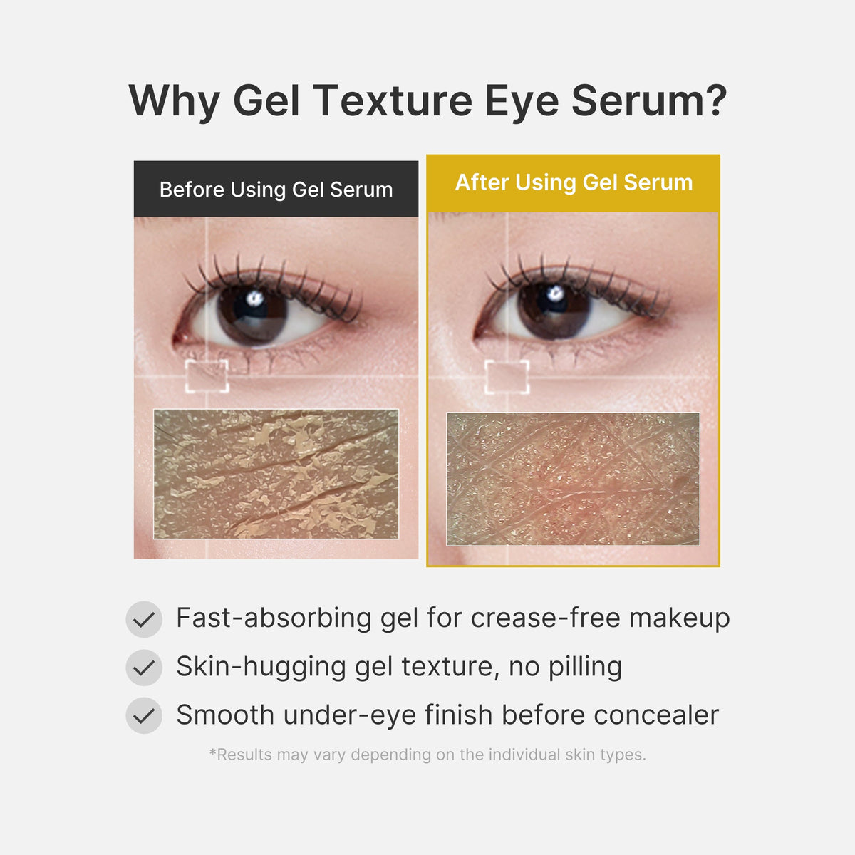 kojic-acid-tumeric-eye-gel-serum-q3 04_0487ef36-49f4-4294-8049-bb55118b05fe.jpg