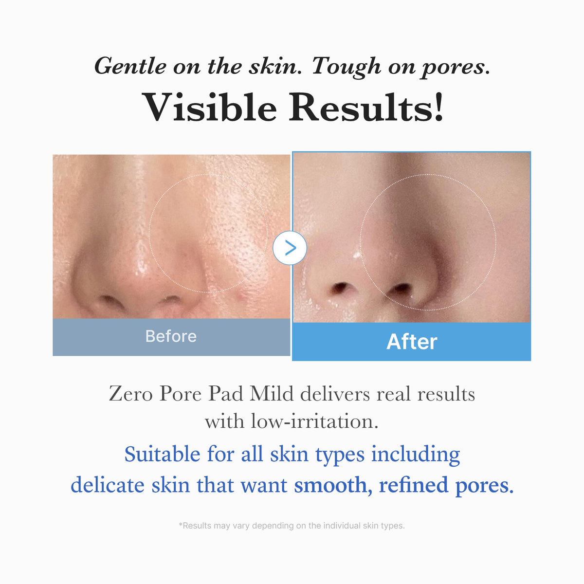 zero-pore-madecassoside-pads-mild-w5 04_6357f9f9-483b-4891-82c6-a58d336e62c8.jpg