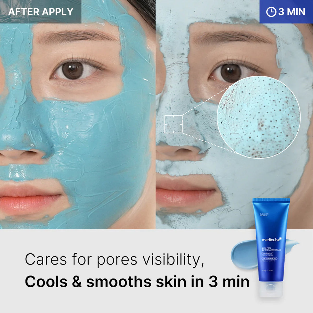zero-pore-blackhead-mud-mask-l1 04_867c0459-a94e-40d3-bd9a-70400edabe8d.jpg