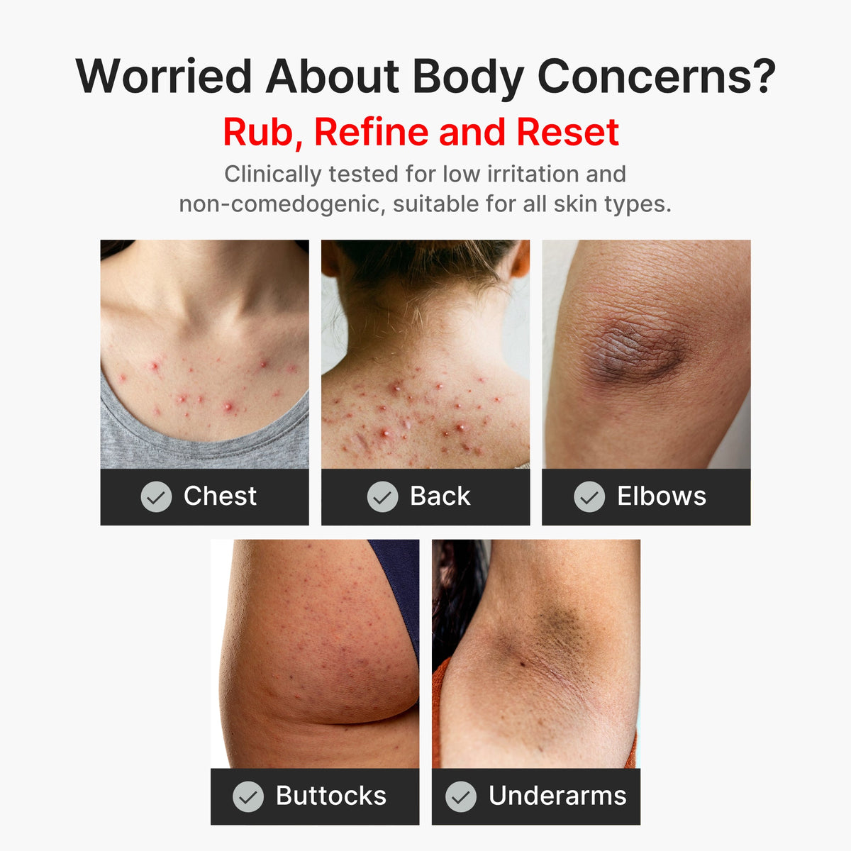 kojic-acid-turmeric-body-peel-shot-o1 04_8a7237f2-3ebf-401e-bd85-54841aeb3efc.jpg