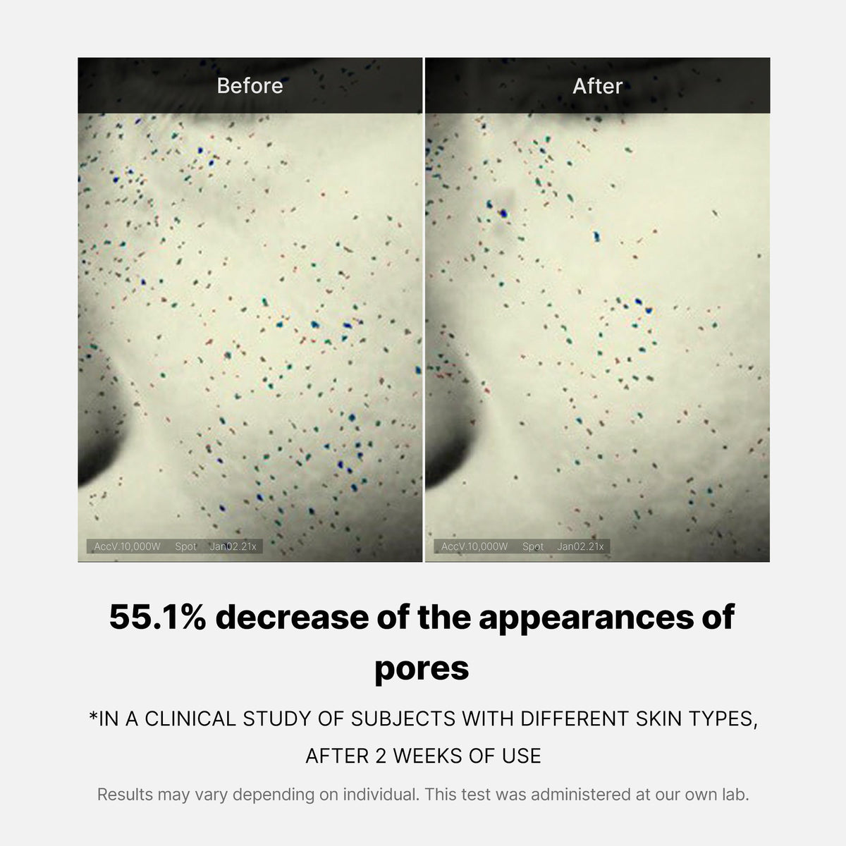 pore-care-duo-r6 05_12ddab8a-64be-4612-8ee1-27e5ec701921.jpg