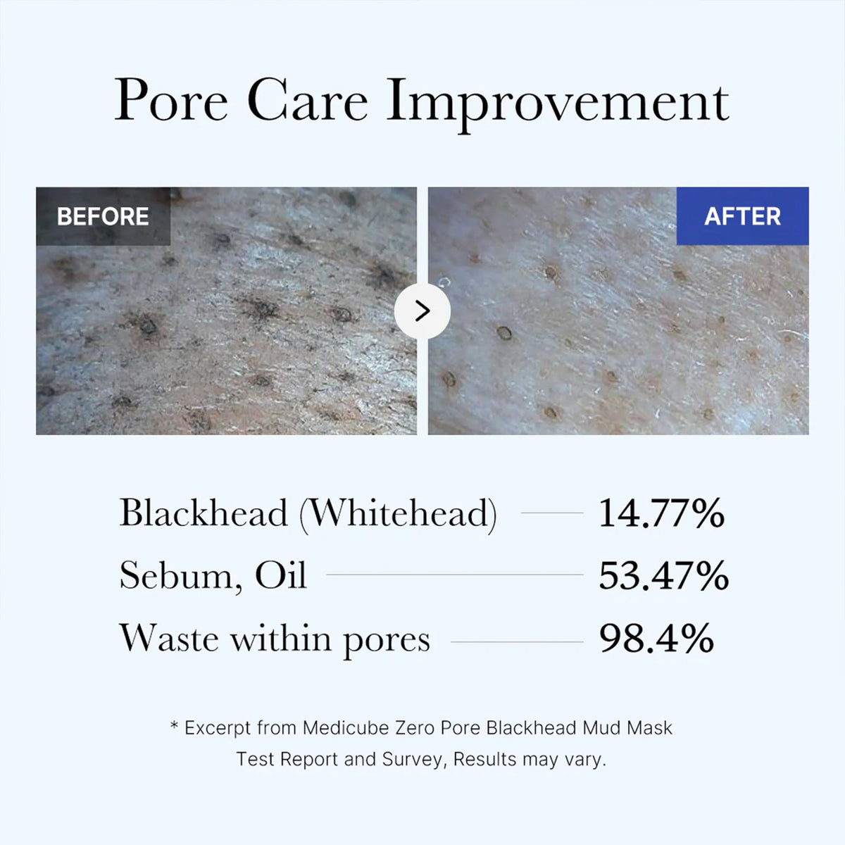 zero-pore-blackhead-mud-mask-l1 05_9362a158-c2b3-4525-acc0-631a2cfdea47.jpg