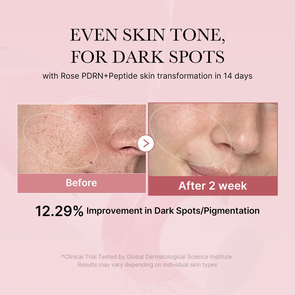 pdrn-pink-peptide-toner-t1 PDRN_01_308c518e-5ac6-4e54-99bd-eabc8796739b.jpg