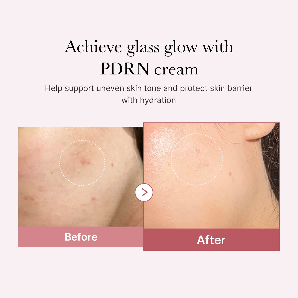 pdrn-pink-peptide-cream-q0 PDRN_02_d7805bfe-cf43-446a-b71b-a276683f136b.jpg