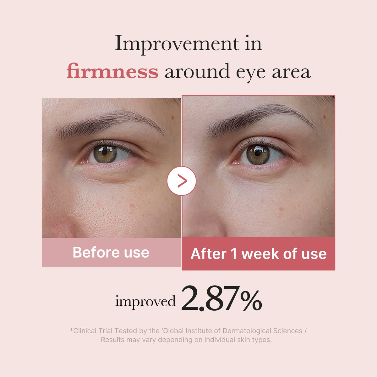 pdrn-pink-peptide-eye-cream-a4 PDRN_03_256dd753-0a2f-41b4-b3cd-bbfd3bc27018.jpg