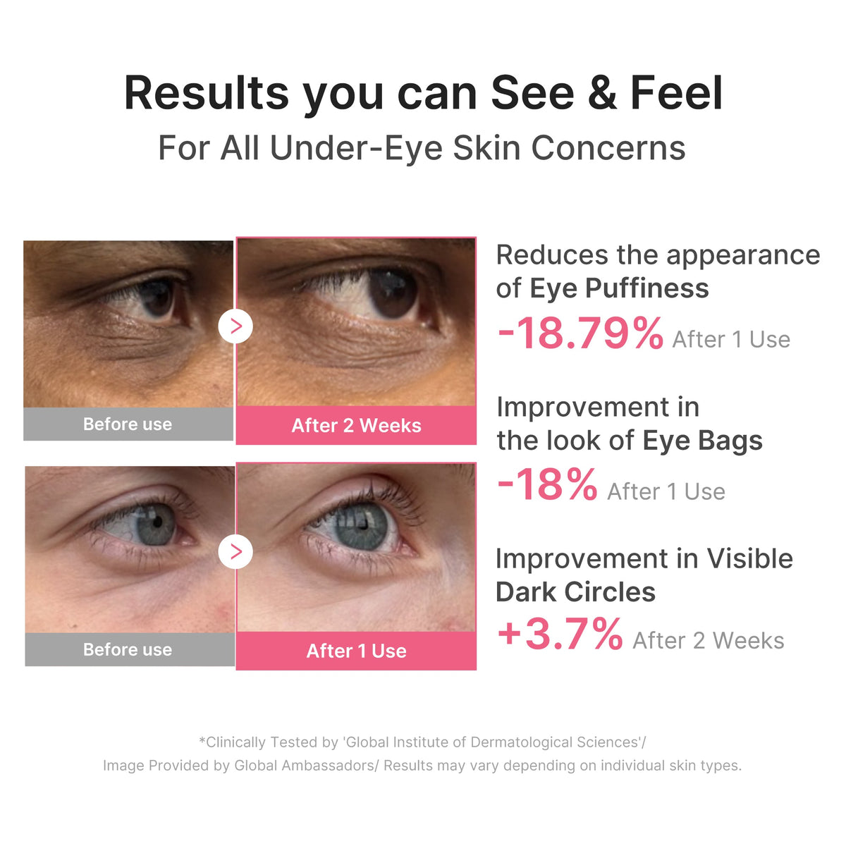 pdrn-caffeine-collagen-eye-patch-n9 PDRN_03_cdce2143-b8d8-43cb-ac69-fcbdf6640249.jpg