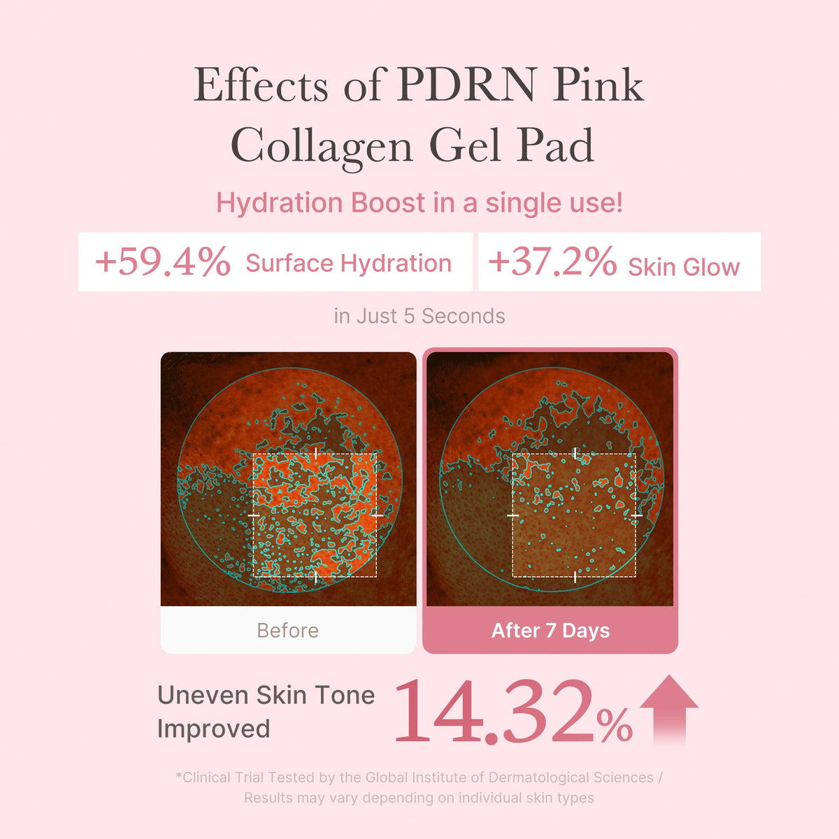 pdrn-pink-collagen-gel-toner-pad-h3 PDRN_04_f9a16a56-8d9e-4c47-a635-ed34ec3ed571.jpg