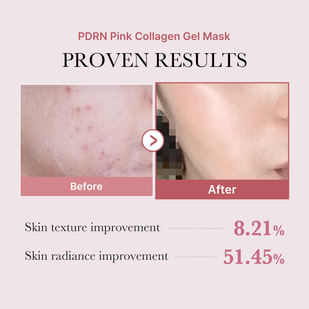 pdrn-pink-glow-full-set-t5 PDRN_12.jpg